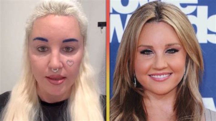 ‘Heart No More’ Amanda Bynes Face Tattoo Removal and Update, Where Is She Now 2022?